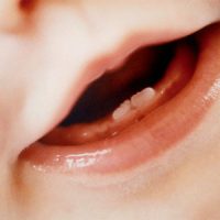 dientes de leche